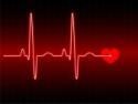 Florida AED Defibrillator Sales